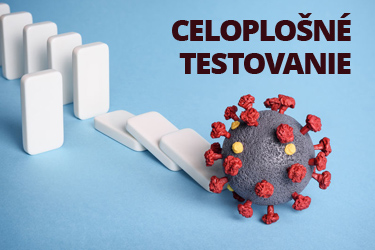 Povinnosť zamestnanca preukázať sa negatívnym testom po celoplošnom testovaní Image51418